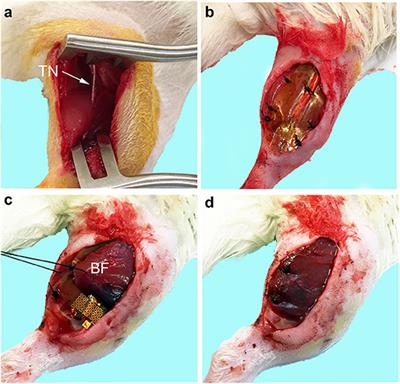 Vascularized Muscle Flap to Reduce Wound Breakdown During Flexible Electrode-Mediated Functional Electrical Stimulation After Peripheral Nerve Injury